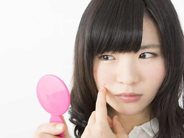 ニキビ