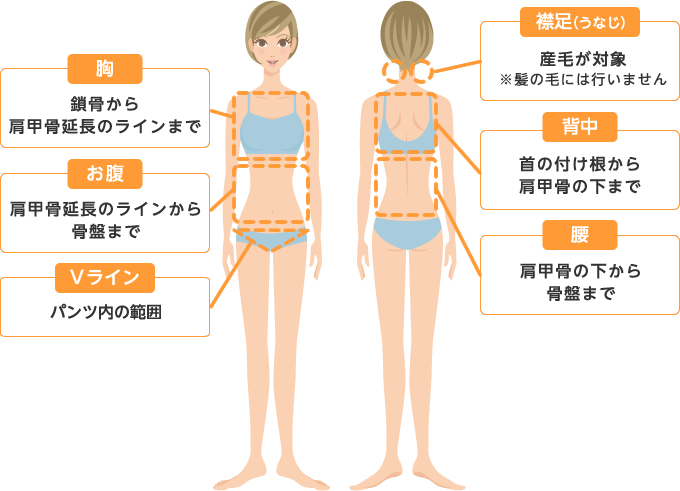 脱毛範囲表
