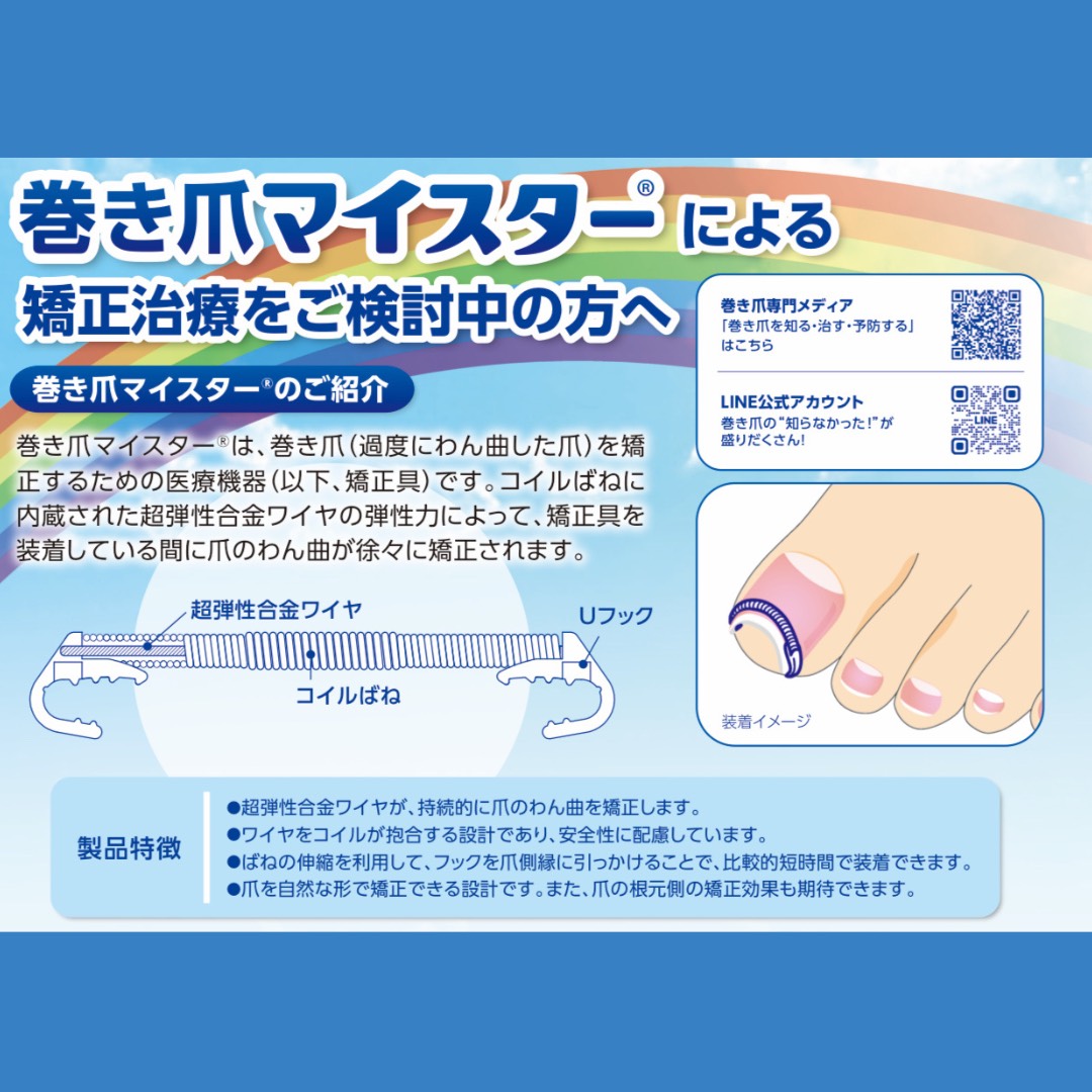 巻き爪治療～リネイルマイスターのご紹介✏️