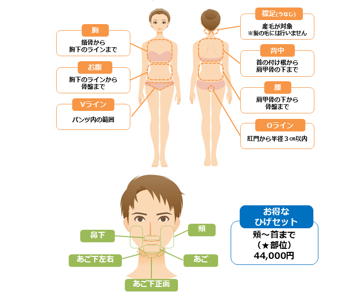 脱毛範囲表